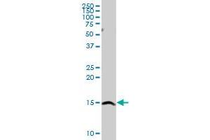 SH2D1A MaxPab rabbit polyclonal antibody. (SH2D1A Antikörper  (AA 1-128))