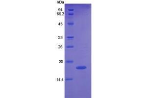 Rabbit Detection antibody from the kit in WB with Positive Control: Sample Human K562 cell lysate. (Angiopoietin 2 CLIA Kit)