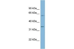 WB Suggested Anti-OSGEP Antibody Titration: 0. (OSGEP Antikörper  (Middle Region))