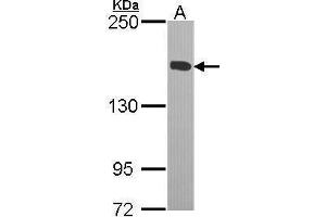 WB Image Sample (30 ug of whole cell lysate) A: H1299 5% SDS PAGE antibody diluted at 1:1000 (KIF4A Antikörper  (C-Term))
