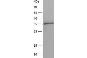 MTHFSD Protein (AA 1-383) (His tag)