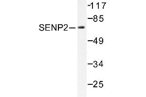 Image no. 1 for anti-SUMO1/sentrin/SMT3 Specific Peptidase 2 (SENP2) antibody (ABIN271956) (SENP2 Antikörper)