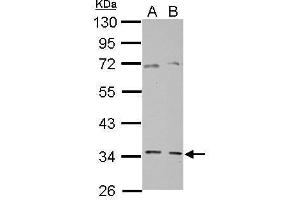 WB Image Sample (30 ug of whole cell lysate) A: PC-3 B: SK-N-SH 10% SDS PAGE antibody diluted at 1:10000 (GGPS1 Antikörper)
