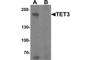 Western blot analysis of TET3 in SK-N-SH cell lysate with TET3 Antibody  at 1 μg/ml in (A) the absence and (B) the presence of blocking peptide (TET3 Antikörper  (C-Term))
