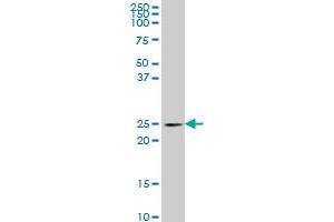 PCMT1 monoclonal antibody (M01), clone 4G9 Western Blot analysis of PCMT1 expression in PC-12 . (PCMT1 Antikörper  (AA 1-228))