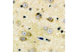Immunohistochemical analysis of Cyclin D2 staining in human brain formalin fixed paraffin embedded tissue section. (Cyclin D2 Antikörper)