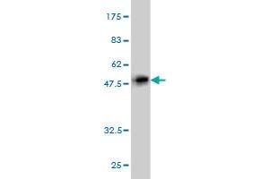 Western Blotting (WB) image for anti-phosphodiesterase 4D Interacting Protein (PDE4DIP) (AA 1-177) antibody (ABIN564175)