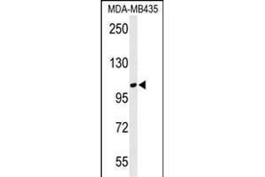 Western blot analysis of LUZP1 Antibody (C-term) (ABIN650909 and ABIN2839991) in MDA-M cell line lysates (35 μg/lane). (LUZP1 Antikörper  (C-Term))