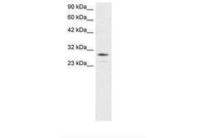 Image no. 3 for anti-Orthodenticle Homeobox 2 (OTX2) (AA 86-135) antibody (ABIN6735803) (OTX2 Antikörper  (AA 86-135))
