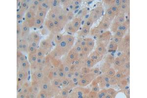 Used in DAB staining on fromalin fixed paraffin- embedded Kidney tissue (PCNT Antikörper  (AA 2987-3246))