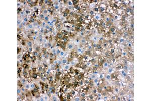 Anti-liver FABP antibody,  IHC(P) IHC(P): Rat Liver Tissue (FABP1 Antikörper  (N-Term))