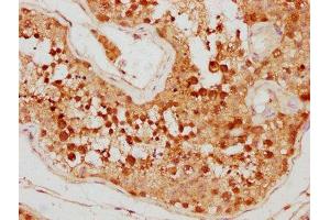 IHC image of ABIN7150970 diluted at 1:500 and staining in paraffin-embedded human testis tissue performed on a Leica BondTM system. (PIAS4 Antikörper  (AA 66-241))