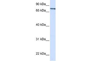 WB Suggested Anti-ZNF180 Antibody Titration:  0. (ZNF180 Antikörper  (Middle Region))