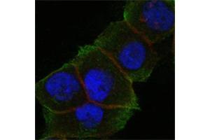 Confocal immunofluorescence analysis of PANC-1 cells using DAXX antibody (green). (DAXX Antikörper)