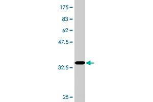 Western Blot detection against Immunogen (36. (RPRD1A Antikörper  (AA 76-170))
