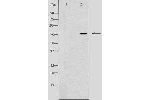 Western blot analysis of extracts from NIH-3T3 cells treated with H2O2 using DBF4 antibody. (DBF4 Antikörper  (Internal Region))