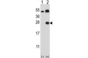 Western Blotting (WB) image for anti-Kallikrein 6 (KLK6) antibody (ABIN5022442) (Kallikrein 6 Antikörper)