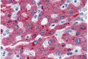 Human Liver (formalin-fixed, paraffin-embedded) stained with CFH antibody ABIN364283 at 20 ug/ml followed by biotinylated anti-mouse IgG secondary antibody ABIN481714, alkaline phosphatase-streptavidin and chromogen. (Complement Factor H Antikörper)