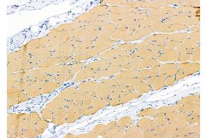 ABIN6265412 and ABIN6279864 at 1/100 staining Rat skin tissue by IHC-P. (SYT10 Antikörper  (C-Term))