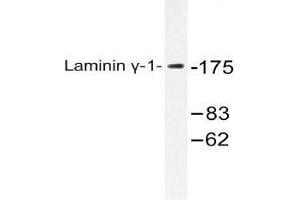 Western blot (WB) analysis of Laminin gamma-1 antibody in extracts from HUVEC cells.