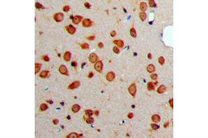 Immunohistochemical analysis of Somatostatin staining in human brain formalin fixed paraffin embedded tissue section.