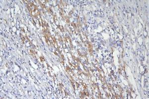 IHC analysis of CD46 using anti-CD46 antibody (ABIN7602758). (CD46 Antikörper  (C-Term))