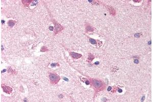 Human Brain, Cortex (formalin-fixed, paraffin-embedded) stained with SMOC2 antibody ABIN290277 at 20 ug/ml followed by biotinylated goat anti-rabbit IgG secondary antibody ABIN481713, alkaline phosphatase-streptavidin and chromogen. (SMOC2 Antikörper  (N-Term))