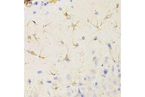 Immunohistochemistry of paraffin-embedded rat brain using KIF1B Antibody. (KIF1B Antikörper  (AA 1501-1770))