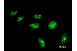 Immunofluorescence of monoclonal antibody to HIST1H4H on HeLa cell.