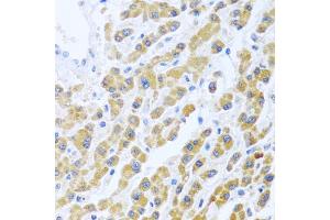 Immunohistochemistry of paraffin-embedded human liver using MANF antibody (ABIN6291535) at dilution of 1:100 (40x lens). (MANF Antikörper)