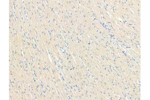 ABIN7094526 and ABIN7098575 at 1/100 staining Rat heart tissue by IHC-P. (GFRA3 Antikörper  (Internal Region))