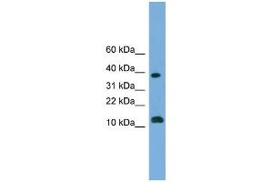 WB Suggested Anti-LOC152586 Antibody Titration: 0. (GL54D Antikörper  (Middle Region))