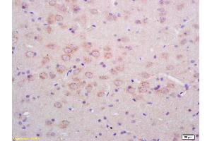 Formalin-fixed and paraffin embedded rat brain labeled with Rabbit Anti Phospho-NMDAR1(Ser890) Polyclonal Antibody, Unconjugated (ABIN744278) at 1:200 followed by conjugation to the secondary antibody and DAB staining (GRIN1/NMDAR1 Antikörper  (pSer890))
