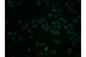 Immunofluorescence staining of A549 cells with ABIN7143977 at 1:100, counter-stained with DAPI. (SCNN1D Antikörper  (AA 292-519))
