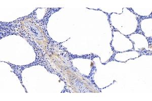 Immunohistochemistry (IHC) image for anti-Elastin (ELN) (AA 392-645) antibody (ABIN7433489)