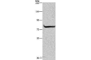 Western blot analysis of 293T cell, using GYS1 Polyclonal Antibody at dilution of 1:300 (Glycogen Synthase 1 Antikörper)