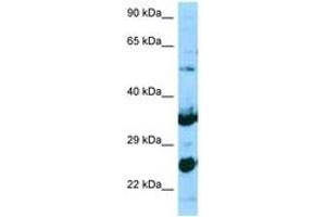Image no. 1 for anti-N-Acetylneuraminate Pyruvate Lyase (Dihydrodipicolinate Synthase) (NPL) (AA 61-110) antibody (ABIN6748246) (NPL Antikörper  (AA 61-110))