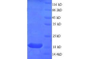 SDS-PAGE (SDS) image for Myosin, Light Chain 2, Regulatory, Cardiac, Slow (MYL2) (AA 8-164), (partial) protein (His tag) (ABIN1047439)