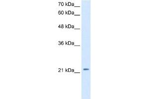 WB Suggested Anti-DKK1 Antibody Titration:  2. (DKK1 Antikörper  (C-Term))