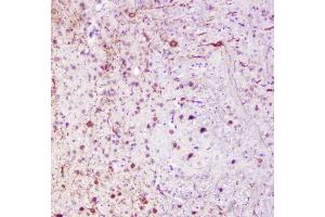 IHC analysis of Calbindin using anti-Calbindin antibody (ABIN6719541). (CALB1 Antikörper  (AA 2-261))