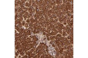 Immunohistochemical staining of human liver with SH2D4A polyclonal antibody  shows strong cytoplasmic positivity in hepatocytes at 1:50-1:200 dilution.