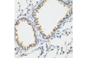 Immunohistochemistry of paraffin-embedded mouse lung using VEGFR3/FLT4 antibody (ABIN6130780, ABIN6140699, ABIN6140702 and ABIN6221242) at dilution of 1:200 (40x lens). (FLT4 Antikörper  (AA 1174-1363))