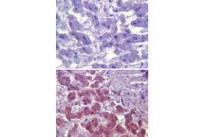 Immunohistochemical analysis of TLR6 in paraffin-embedded formalin-fixed human liver tissue using an isotype control (top) and TLR6 monoclonal antibody, clone 86B1153. (TLR6 Antikörper  (AA 408-424))