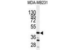 Image no. 1 for anti-Cathepsin S (CTSS) (Middle Region) antibody (ABIN452893) (Cathepsin S Antikörper  (Middle Region))