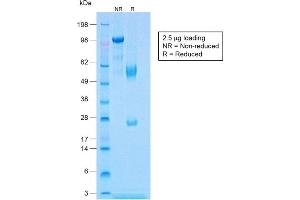SDS-PAGE Analysis of Purified Calponin Rabbit Recombinant Monoclonal Antibody (CNN1/1408R).