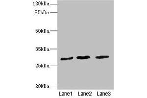 Western blot All lanes: RCHY1 antibody at 3. (RCHY1 Antikörper  (AA 1-261))