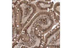 Immunohistochemical staining of human duodenum with ATAD2B polyclonal antibody  shows moderate cytoplasmic and nuclear positivity in glandular cells at 1:50-1:200 dilution. (ATAD2B Antikörper)