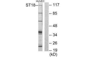 Western blot analysis of extracts from HUVEC cells, using ZNF387 antibody.