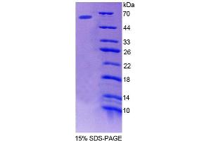 SDS-PAGE analysis of Human bACE1 Protein. (BACE1 Protein)