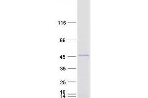 Western Blotting (WB) image for Periphilin 1 (PPHLN1) (Transcript Variant 5) protein (Myc-DYKDDDDK Tag) (ABIN2728686)